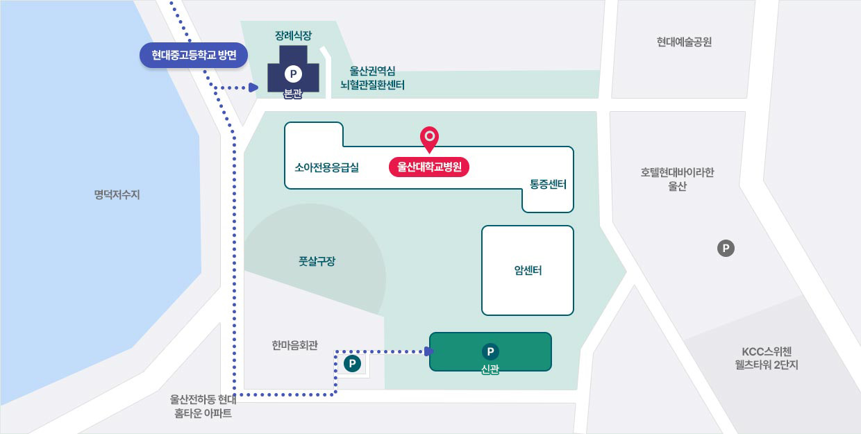 현대중고등학교 방면에서 울산대학교병원 주차장 안내 지도로 자세한 내용은 아래 참조