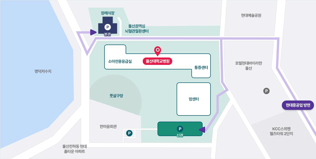 현대중공업 방면에서 울산대학교병원 주차장 안내 지도로 자세한 내용은 아래 참조